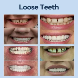 𝐀𝐝𝐚𝐩𝐭𝐢𝐯𝐞 𝐃𝐞𝐧𝐭𝐮𝐫𝐞𝐬 - Image 10