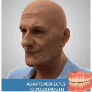 Advanced Custom-Fit Functional Dentures - Image 7