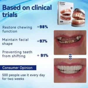 🦷Advanced Customized Full Denture Set🦷 (⏰Limited time discount last 30 minutes⏰) - Image 3