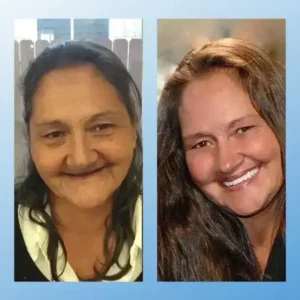 𝗙𝘂𝗻𝗰𝘁𝗶𝗼𝗻𝗮𝗹 𝗧𝗵𝗶𝗰𝗸𝗲𝗻𝗲𝗱 𝗗𝗲𝗻𝘁𝘂𝗿𝗲𝘀 - Image 4