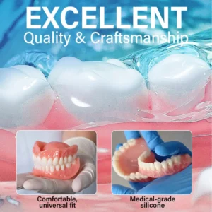 Suction-fit Complete Denture - Image 8