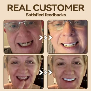 🐱‍🐉💦- 𝐏𝐫𝐞𝐦𝐢𝐮𝐦 𝐃𝐞𝐧𝐭𝐮𝐫𝐞- (✨Suitable for all mouth shapes, custom-made dentures for a perfect fit✨） - Image 8