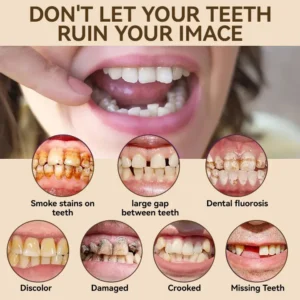 🐱‍🐉💦- 𝐏𝐫𝐞𝐦𝐢𝐮𝐦 𝐃𝐞𝐧𝐭𝐮𝐫𝐞- (✨Suitable for all mouth shapes, custom-made dentures for a perfect fit✨） - Image 9