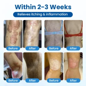Magnesium Herbal Treatment Spray - Image 11