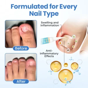Nail Revive Pen - Image 10