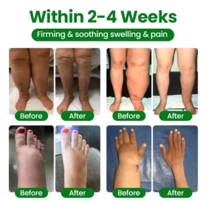 VenoLift Leg Relief Spray - Image 6