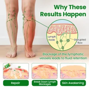 VenoLift Leg Relief Spray - Image 7