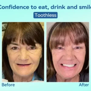 💎𝐏𝐫𝐞𝐦𝐢𝐮𝐦 𝐃𝐞𝐧𝐭𝐮𝐫𝐞(🦷𝐋𝐢𝐦𝐢𝐭𝐞𝐝 𝐭𝐢𝐦𝐞 𝐝𝐢𝐬𝐜𝐨𝐮𝐧𝐭 𝐋𝐚𝐬𝐭 𝟑𝟎 𝐦𝐢𝐧𝐮𝐭𝐞𝐬🦷) - Image 10