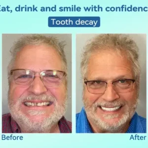 💎𝐏𝐫𝐞𝐦𝐢𝐮𝐦 𝐃𝐞𝐧𝐭𝐮𝐫𝐞(🦷𝐋𝐢𝐦𝐢𝐭𝐞𝐝 𝐭𝐢𝐦𝐞 𝐝𝐢𝐬𝐜𝐨𝐮𝐧𝐭 𝐋𝐚𝐬𝐭 𝟑𝟎 𝐦𝐢𝐧𝐮𝐭𝐞𝐬🦷) - Image 8