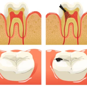 Herbal Brightening Oral Repair Foam - Image 4