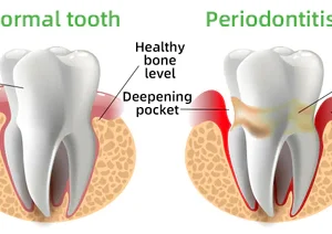 Herbal Brightening Oral Repair Foam - Image 5