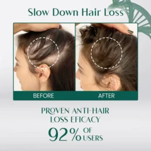 Hair Growth Spray - Image 3