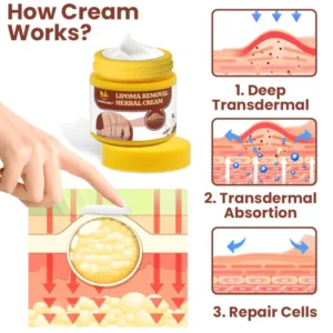 Lipoma Removal Herbal Cream - Image 5
