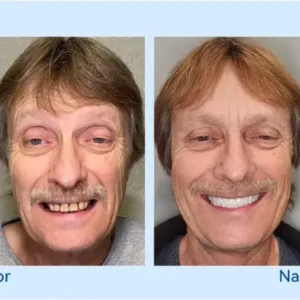 🦷𝐅𝐨𝐫𝐭𝐬𝐜𝐡𝐫𝐢𝐭𝐭𝐥𝐢𝐜𝐡 𝐌𝐚ß𝐠𝐞𝐟𝐞𝐫𝐭𝐢𝐠𝐭 𝐕𝐨𝐥𝐥𝐩𝐫𝐨𝐭𝐡𝐞𝐬𝐞𝐧-𝐒𝐞𝐭 - Image 11