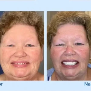 🦷𝐅𝐨𝐫𝐭𝐬𝐜𝐡𝐫𝐢𝐭𝐭𝐥𝐢𝐜𝐡 𝐌𝐚ß𝐠𝐞𝐟𝐞𝐫𝐭𝐢𝐠𝐭 𝐕𝐨𝐥𝐥𝐩𝐫𝐨𝐭𝐡𝐞𝐬𝐞𝐧-𝐒𝐞𝐭 - Image 8