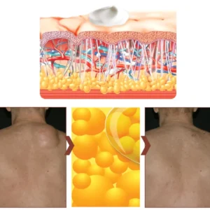 Lipoma Removal Herbal Cream - Image 7