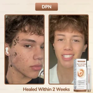 𝐒𝐭𝐞𝐦 𝐂𝐞𝐥𝐥 𝐏𝐃𝐑𝐍 𝐑𝐞𝐩𝐚𝐢𝐫 𝐌𝐢𝐥𝐤 - Image 3