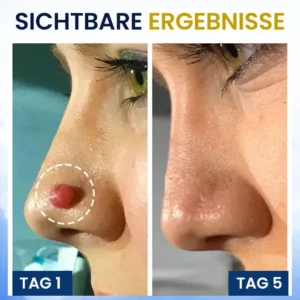 Kryo-Behandlungsspray - Image 7