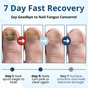 Fungal Nail Patches - Image 4