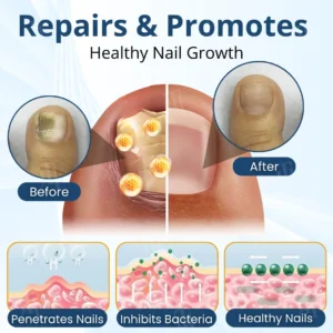 Fungal Nail Patches - Image 5