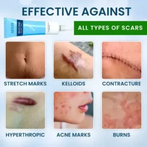 Silicone Scar Gel - Image 5