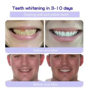 Teeth Restoration Mineral Powder - Image 6