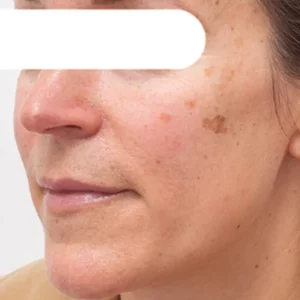 Herbal Spots Peel-Off Facial Mask - Image 6