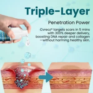 Advanced Scar Gel - Image 5