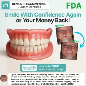 Custom-Fit Fully Functional Dentures - Image 10