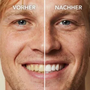 Tooth Polish - Instant Clean Smile - Image 3