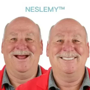 GelFit Dentures - Image 5