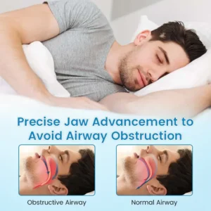 Sleep & Relax Breathing Protector – Dentist-Designed - Image 6