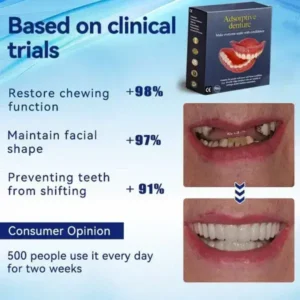 Adsorptive Dentures - Image 6