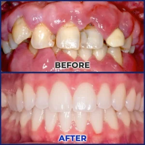 Bee Venom Dental Treatment Drops Mouthwash - Image 12