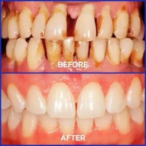 Bienengift-Zahntherapie Oral Power - Image 6