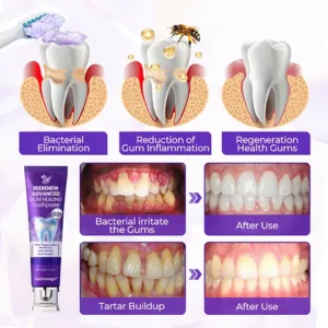 Advanced Gum Regeneration Toothpaste - Image 6