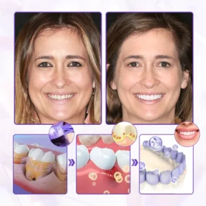 Advanced Gum Regeneration Toothpaste - Image 2