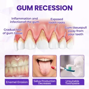 Advanced Gum Regeneration Toothpaste - Image 7