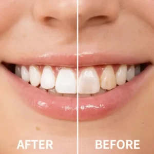 Instantly Whiter Smile🦷 - Image 5