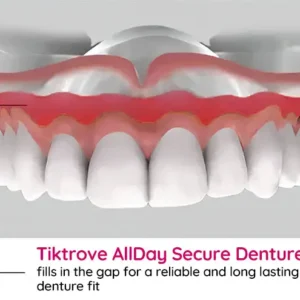 TIKTROVE AllDay Secure Denture Bond - Image 7