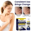 Cryo Freeze Spray