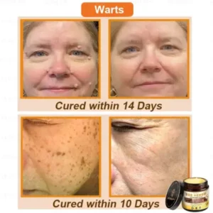 Bee Venom Skin Restoration Cream - Image 4
