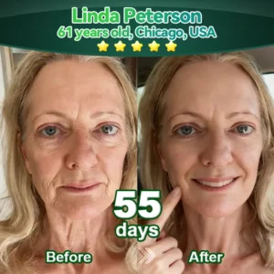 𝗦𝘁𝗲𝗺 𝗖𝗲𝗹𝗹–𝗔𝗰𝘁𝗶𝘃𝗮𝘁𝗲𝗱 𝗖𝗼𝗹𝗹𝗮𝗴𝗲𝗻 𝗣𝗲𝗽𝘁𝗶𝗱𝗲 𝗱𝗿𝗼𝗽𝘀 - Image 7