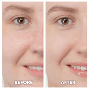 DermaLift 5-in-1 Facial Sculptor & Cleanser Device - Image 11