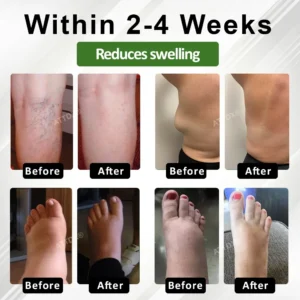 SpiculeFlow Advanced Edema Drainage Cream - Image 6
