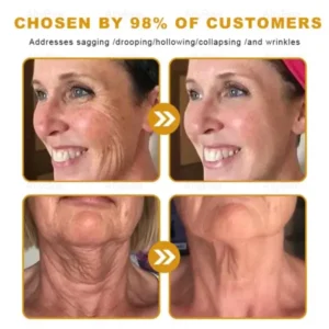 Botox Skin Treatment Cream - Image 10