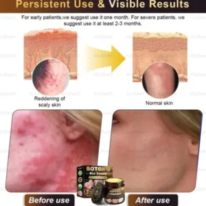 Botox Skin Treatment Cream - Image 7
