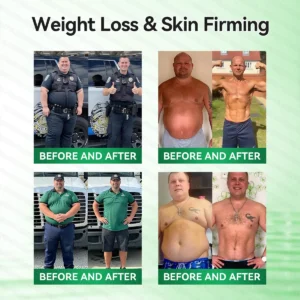Caffeine · L-Carnitine × Retinol | Slimming & Firming 2-in-1 Nano Microneedle Patch - Image 3