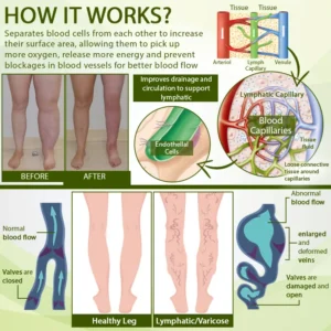 SwellFree Lymphatic Herbal Cream - Image 6