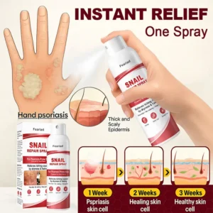 Feariad Snail Repair Spray for Itchy, Flaky Psoriasis Skin - Image 5